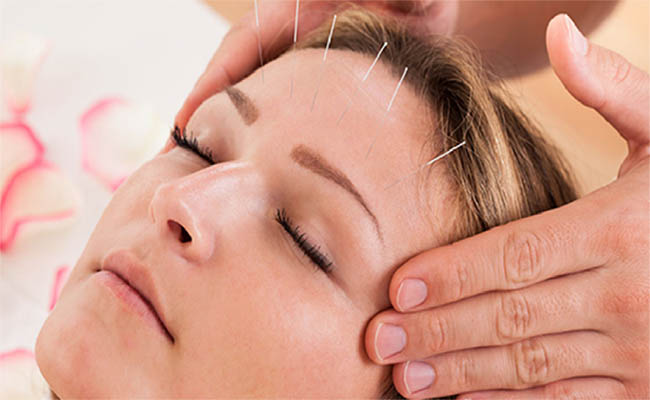 Anti Aging Acupuncture Brisbane