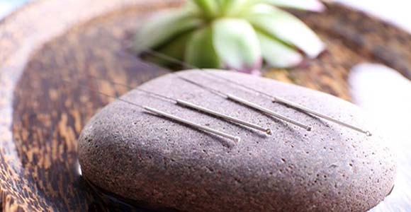 Acupuncture Brisbane North