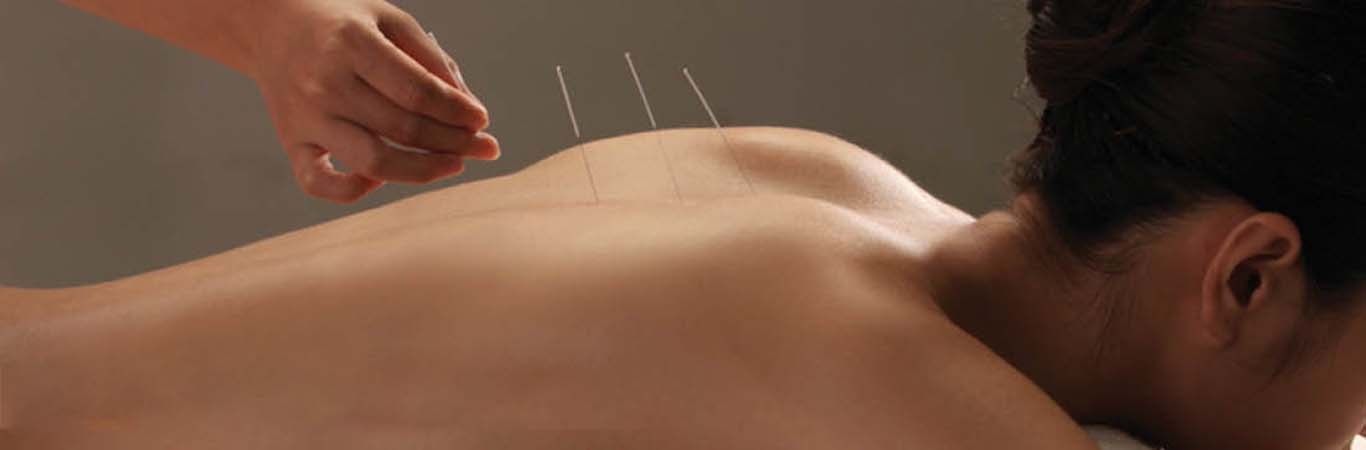 Slider Acupuncture