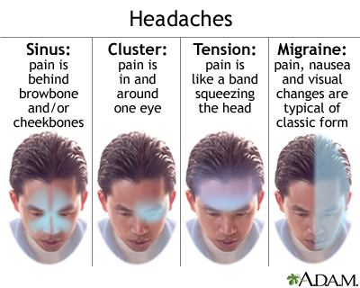 types of headaches